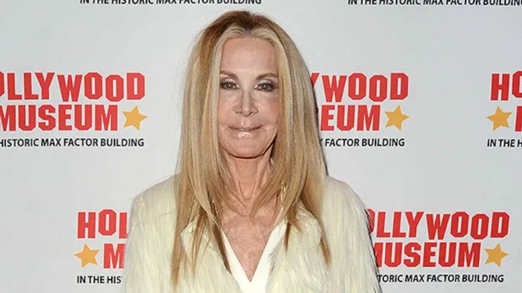 Joan Van Ark Plastic Surgery The Knots Landing Star Then and Now!