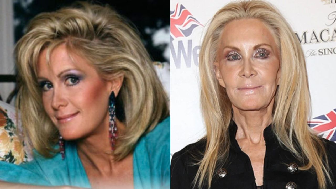 Joan Van Ark has had tons of plastic surgery to look young. houseandwhips.com