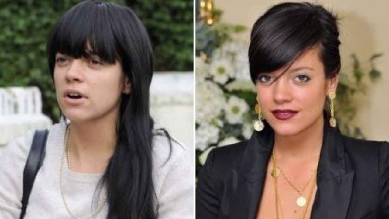 Lily Allen before and after plastic surgery. houseandwhips.com