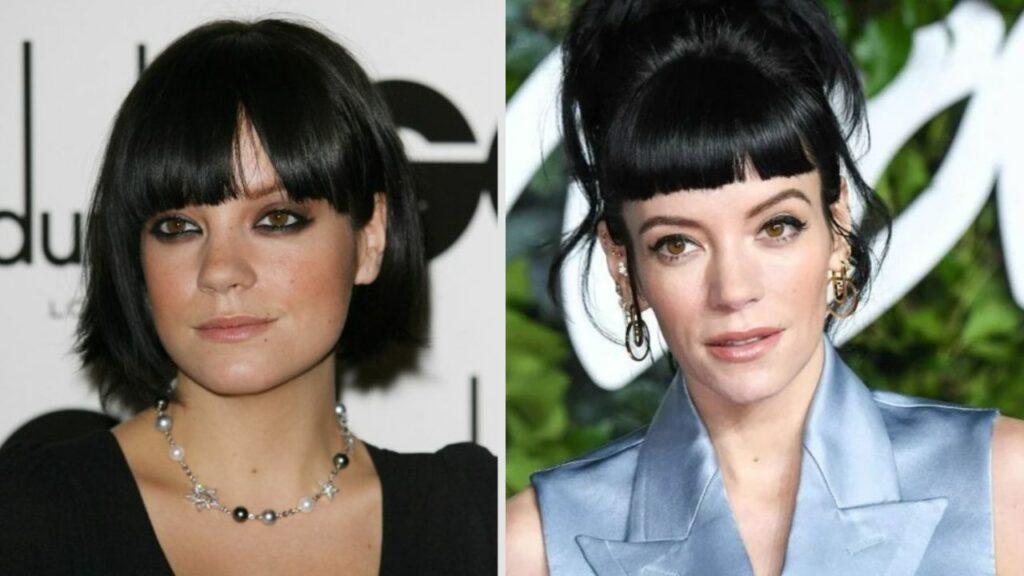 Lily Allen’s Plastic Surgery: Her New Face Examined! houseandwhips.com