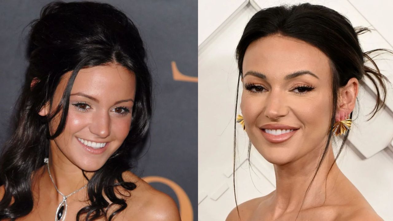 Michelle Keegan is suspected of having plastic surgery including Botox, fillers, and a nose job. houseandwhips.com