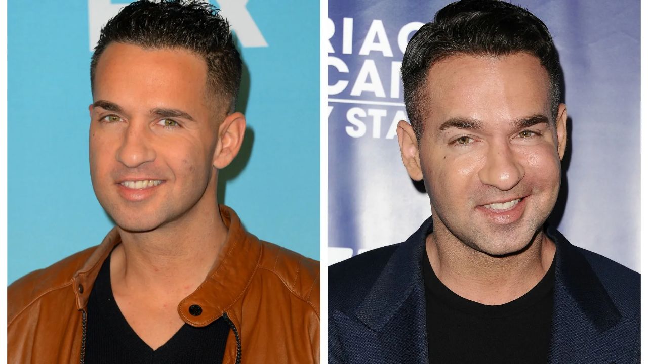 Mike Sorrentino was alleged to have gone to Dr. John Tutela for Botox injections. houseandwhips.com