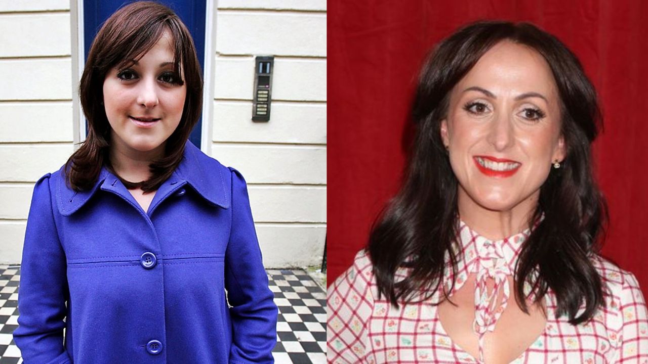 Natalie Cassidy is suspected of having plastic surgery on her face. houseandwhips.com