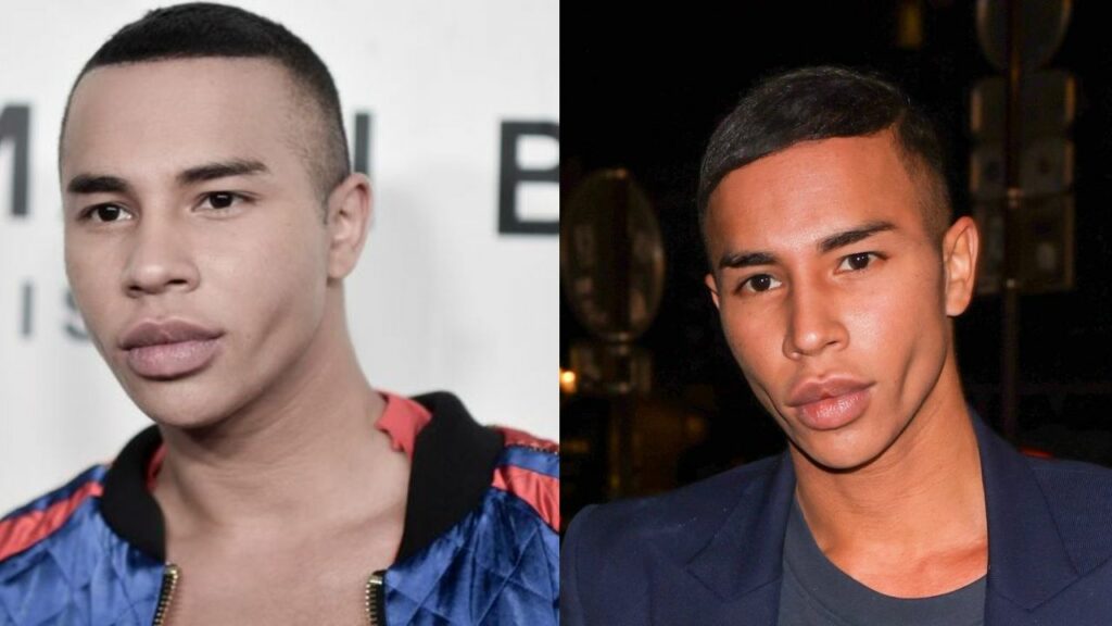 Olivier Rousteing is suspected of having plastic surgery. houseandwhips.com