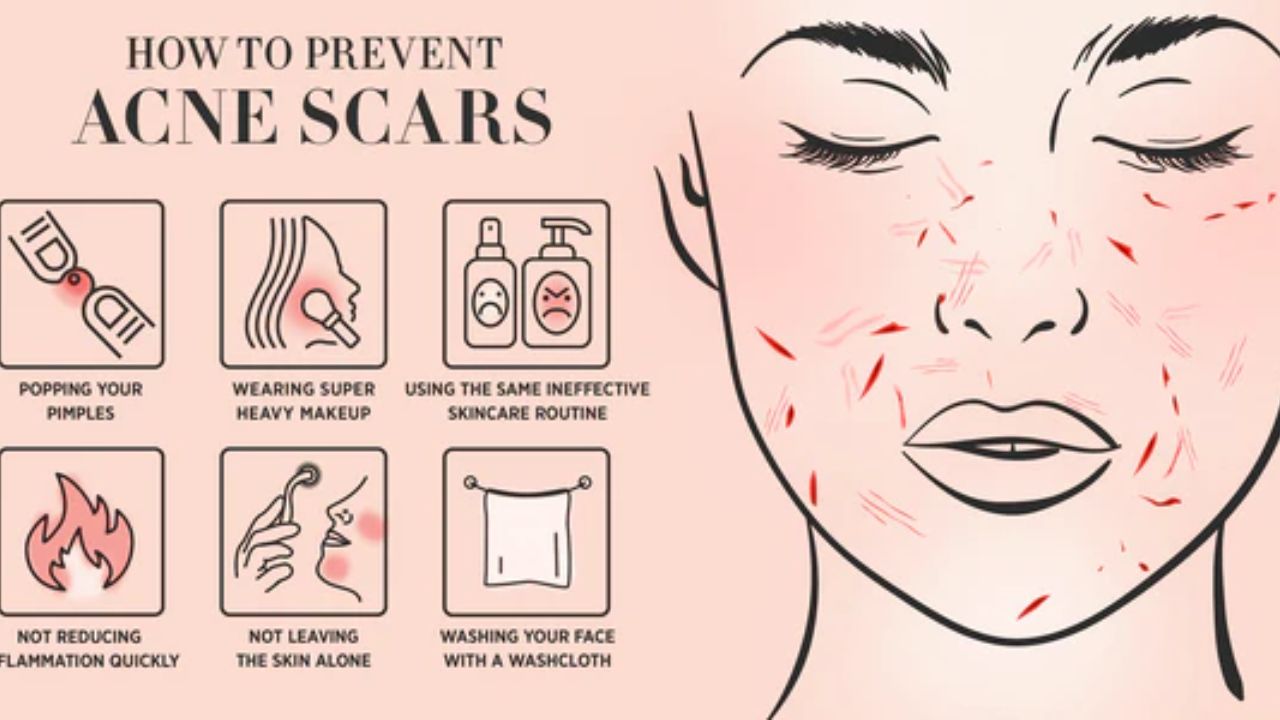 Scars can be prevented if treated at the right time. houseandwhips.com