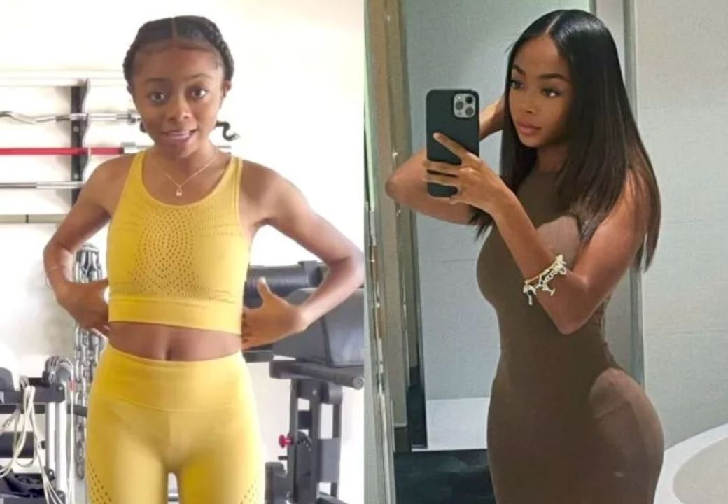 Skai Jackson previously denied receiving a Brazilian Butt Lift (BBL). houseandwhips.com