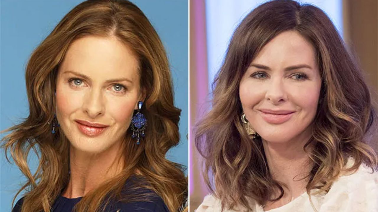 Trinny Woodall before and after plastic surgery. houseandwhips.com