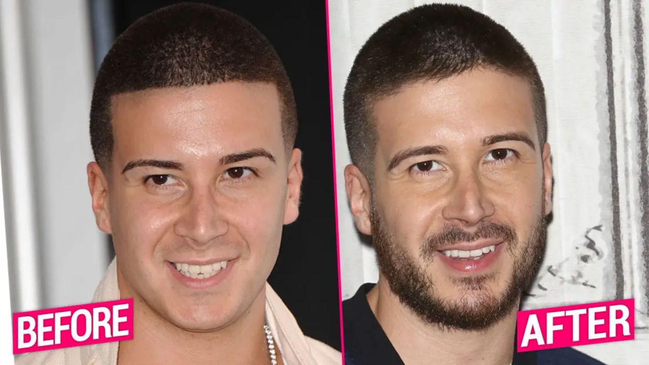 Vinny Guadagnino is suspected of having a nose job. houseandwhips.com