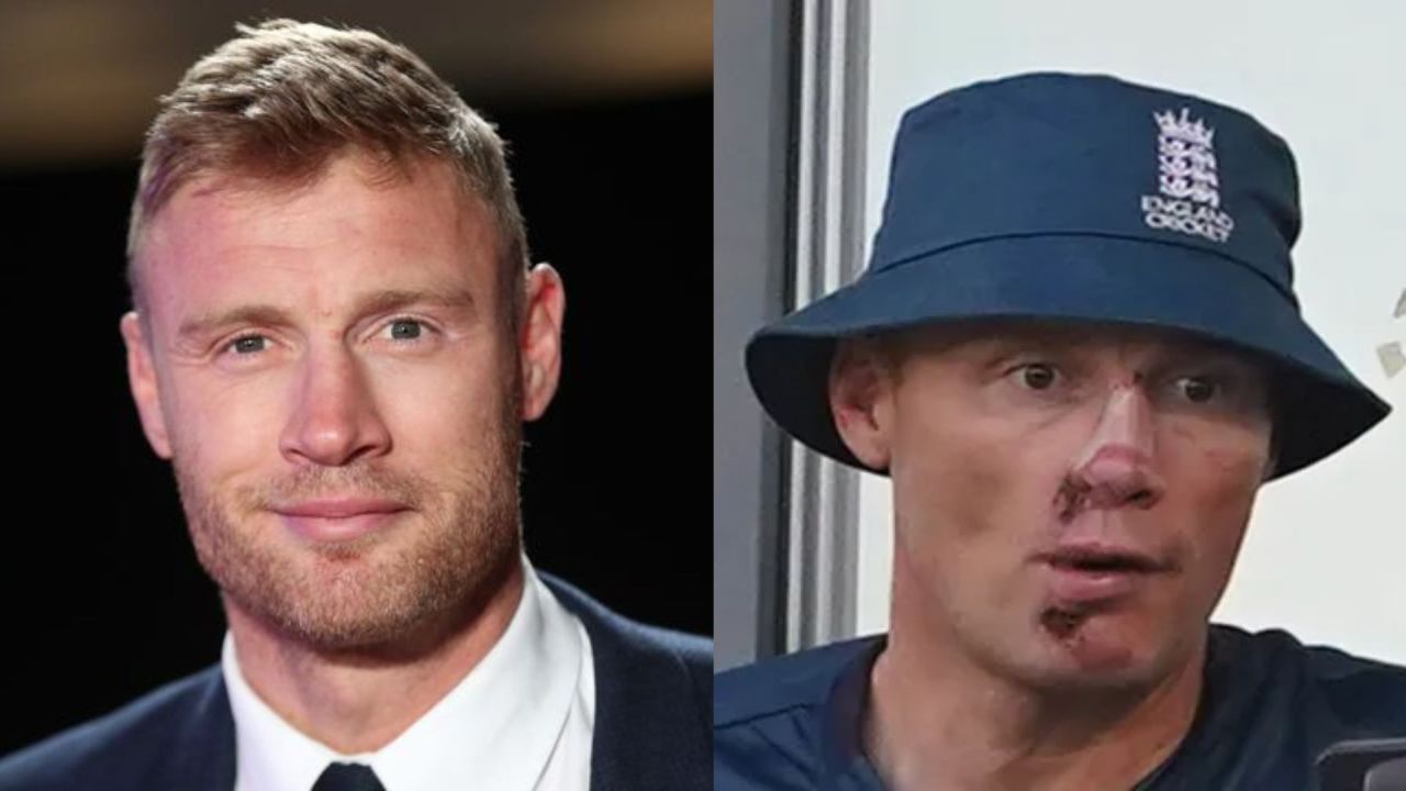 Freddie Flintoff seems to have had lots of plastic surgery to fix his face. houseandwhips.com