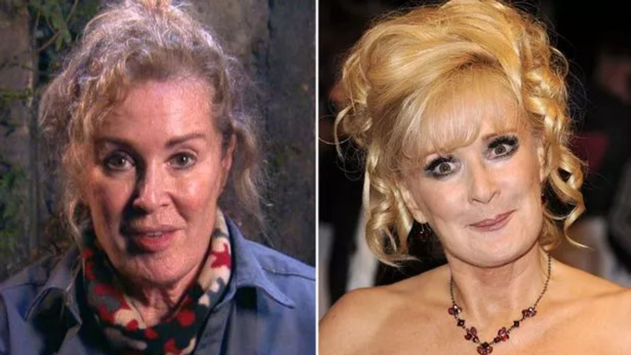 Beverley Callard before and after plastic surgery. houseandwhips.com