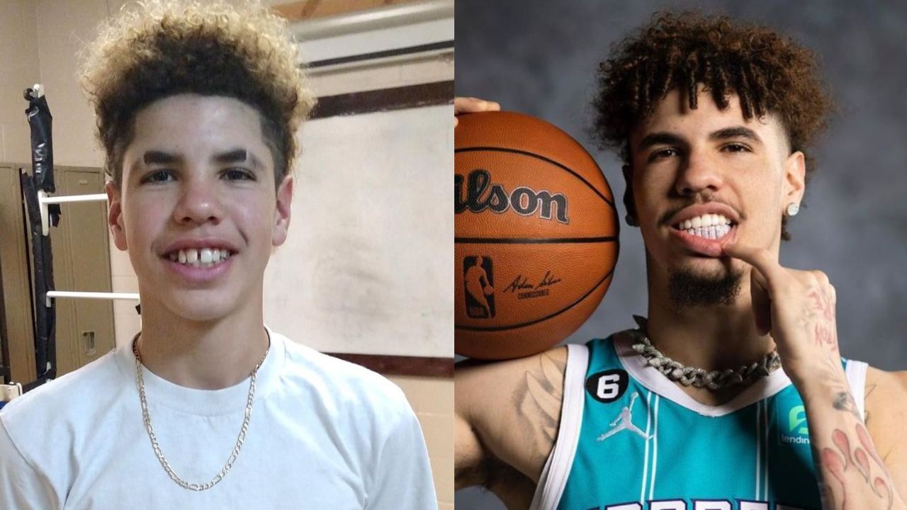 LaMelo Ball before and after getting diamond teeth. houseandwhips.com