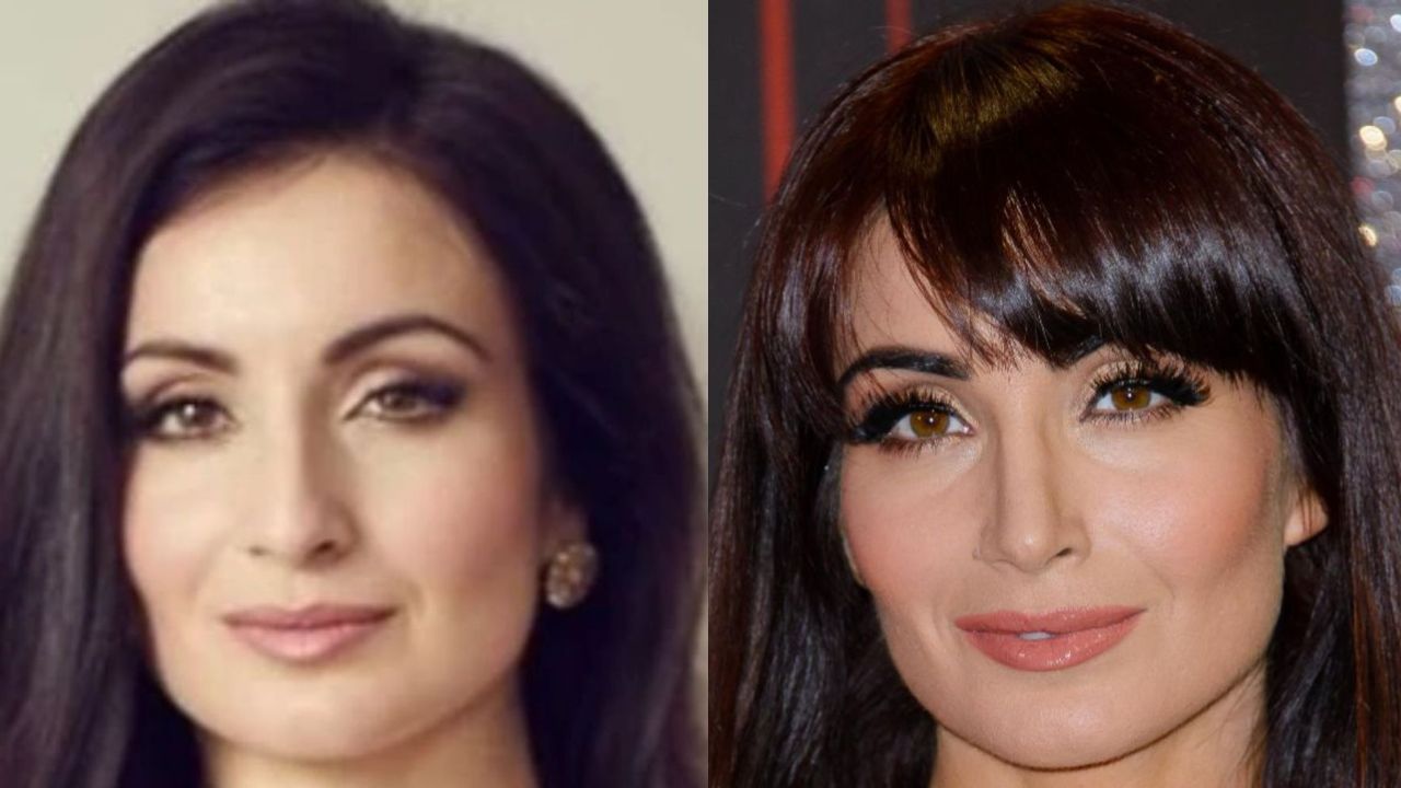 Emmerdale: Leyla Plastic Surgery; Before & After Photos Examined! houseandwhips.com