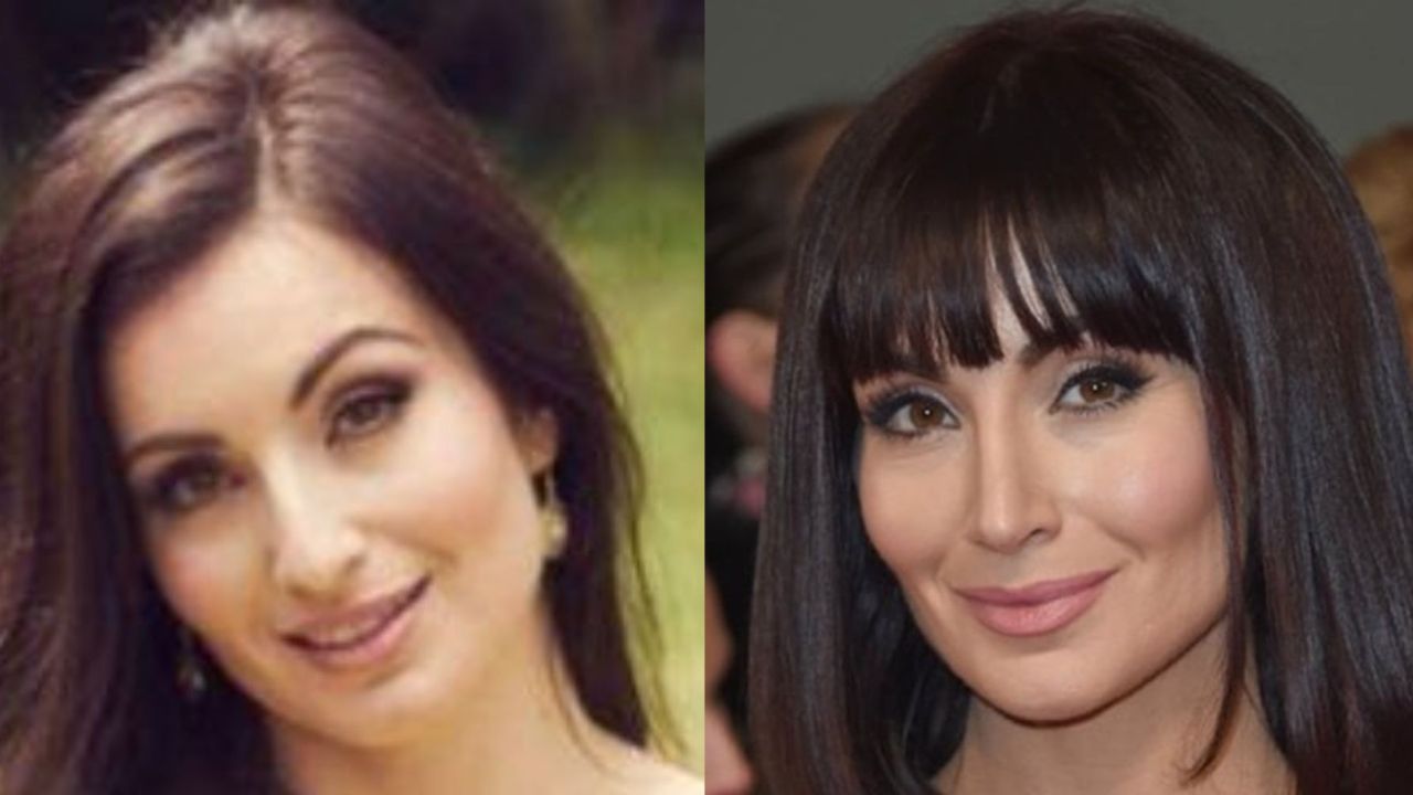 The Leyla Harding actress before and after plastic surgery. houseandwhips.com