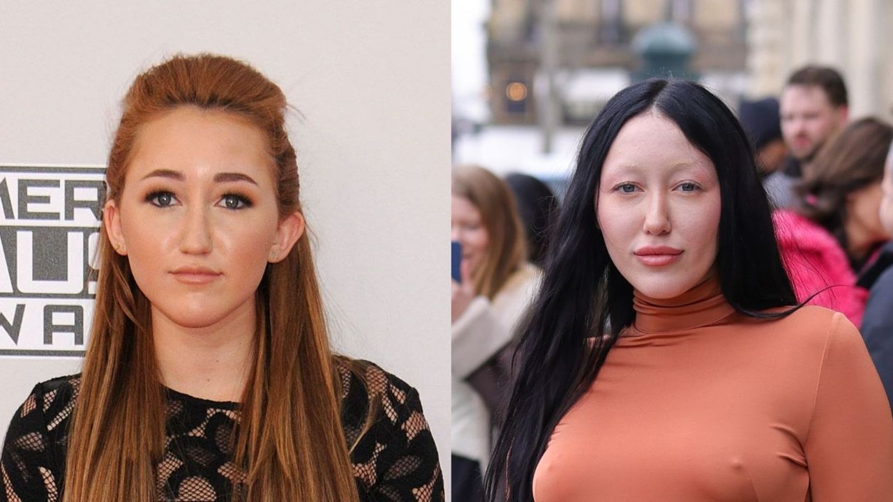 Noah Cyrus appears to have had tons of plastic surgery. houseandwhips.com