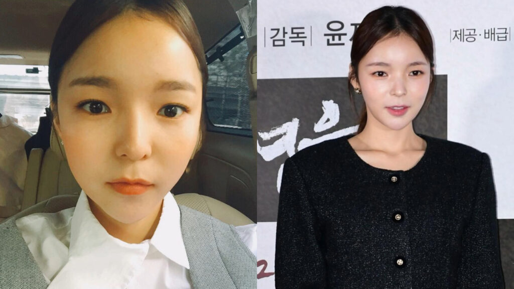 Park Jin Joo Plastic Surgery: What Is Her Secret of Beauty?