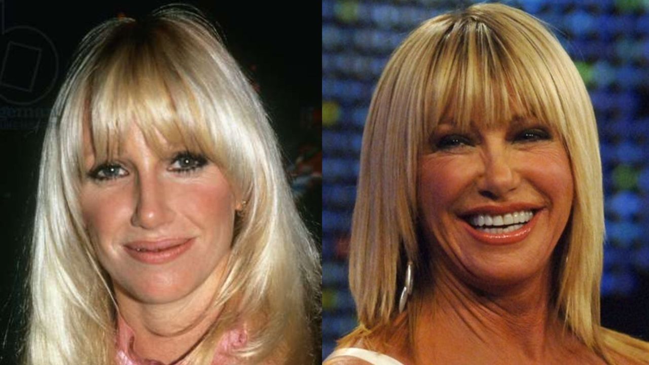 Know About Suzanne Somers’ Plastic Surgery With Her Then and Now Photos! houseandwhips.com