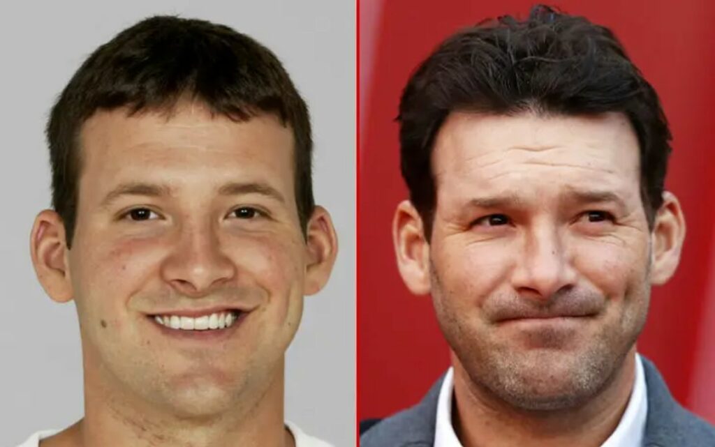 Tony Romo Plastic Surgery: Unravelling The Former NFL Star’s ...