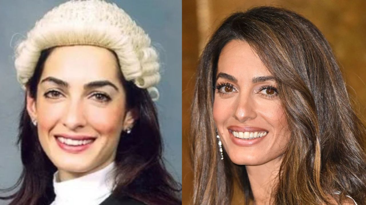 Amal Clooney before and after plastic surgery. houseandwhips.com