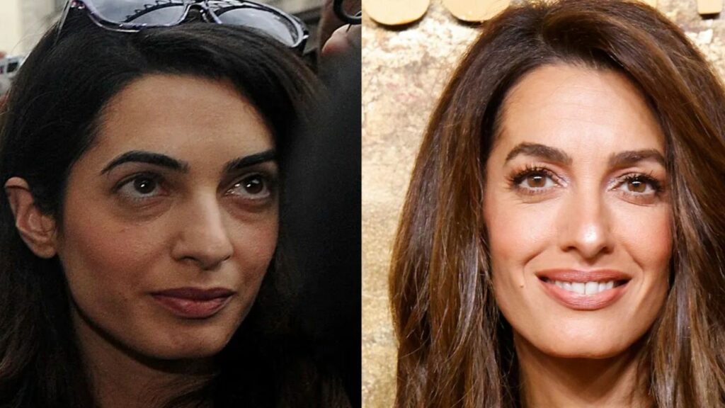 Is Plastic Surgery the Reason Behind Amal Clooney’s Beauty? houseandwhips.com