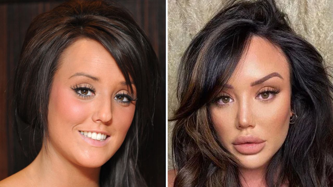 Charlotte Crosby before and after plastic surgery. houseandwhips.com