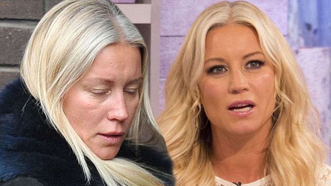 Denise Van Outen before and after plastic surgery. houseandwhips.com
