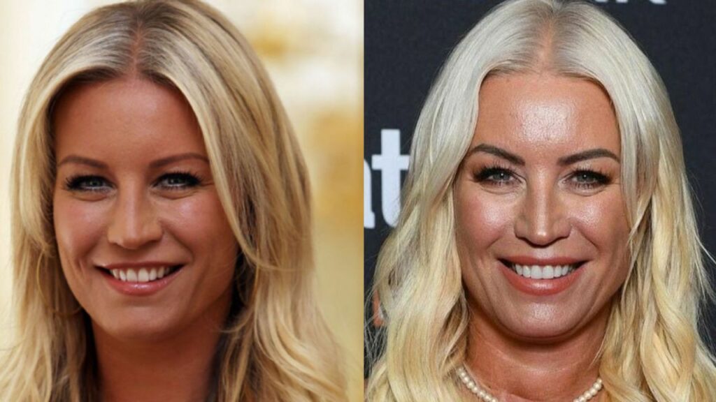 Denise Van Outen Plastic Surgery: What Is Her Secret to Stay Young? houseandwhips.com