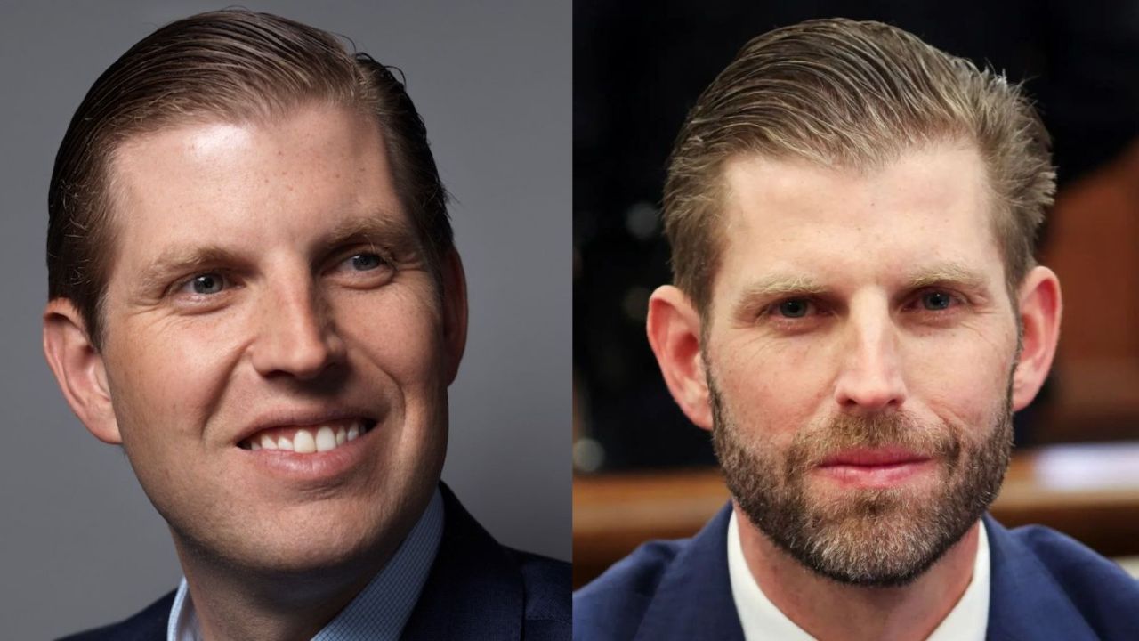 Eric Trump Plastic Surgery: Then and Now Pictures Examined!