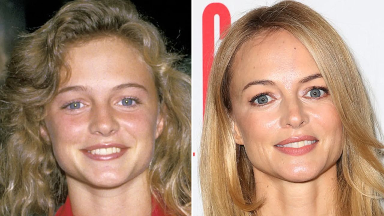Heather Graham before and after plastic surgery. houseandwhips.com