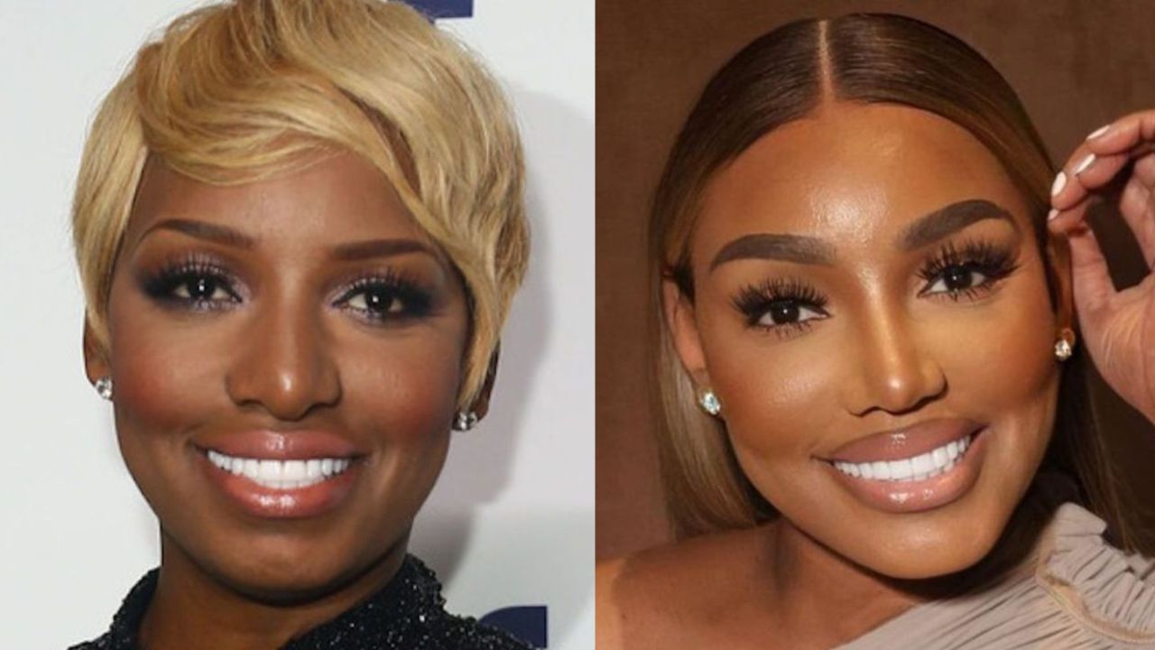NeNe Leakes Before and After Plastic Surgery: How Does She Look Now? houseandwhips.com