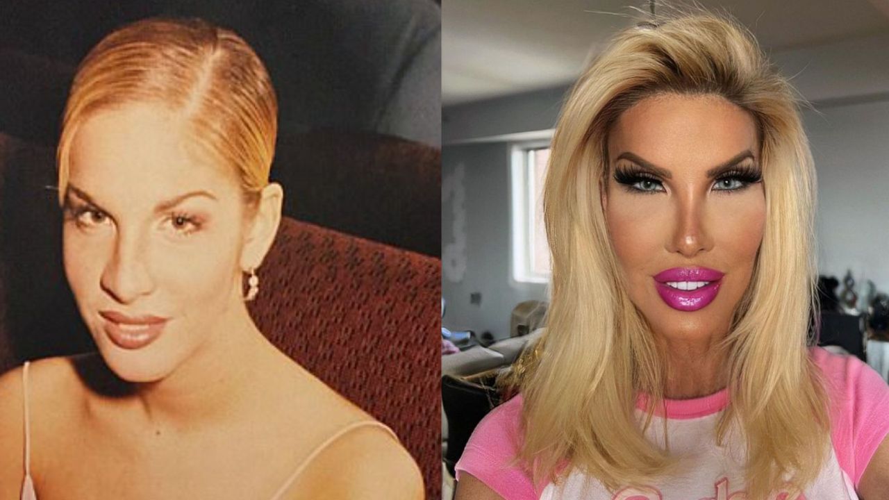 Nikki Exotika Before and After Plastic Surgery Examined! houseandwhips.com