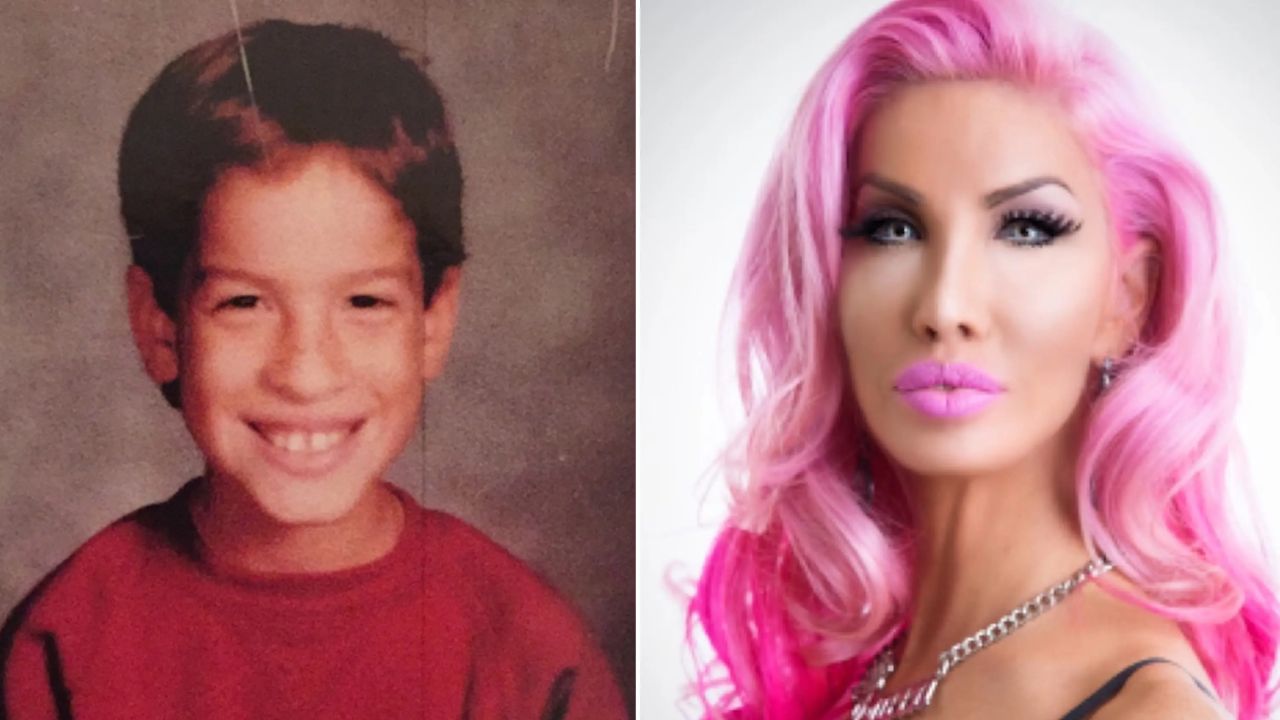 Nikki Exotika before and after plastic surgery. houseandwhips.com