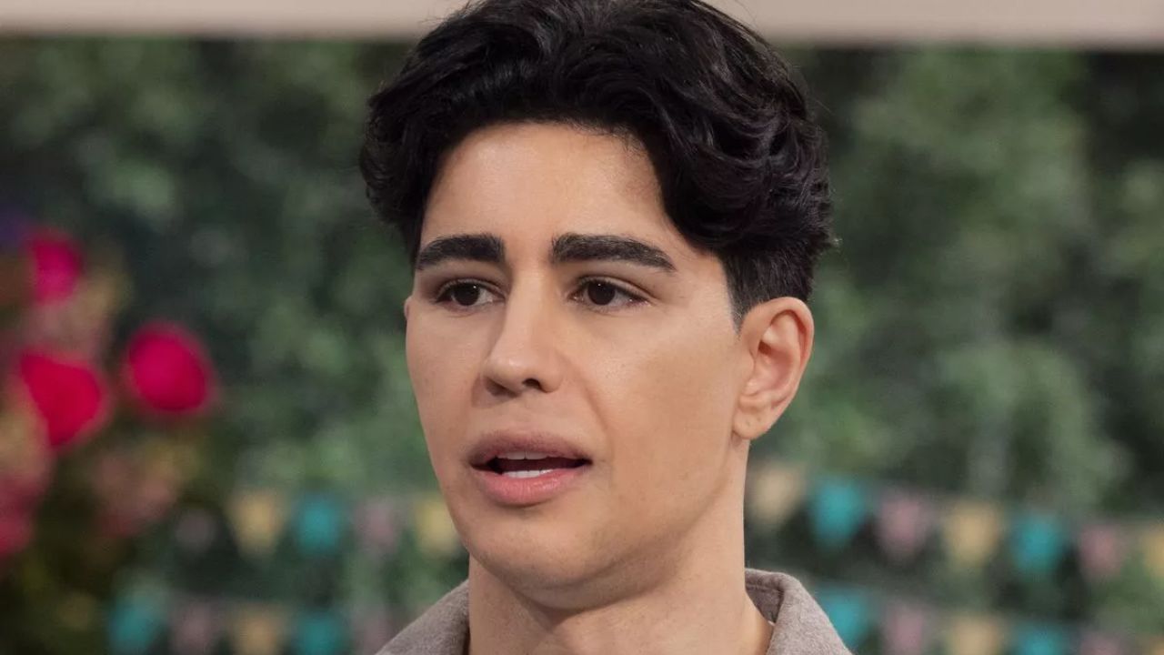 Omid Scobie appears to have had tons of plastic surgery. houseandwhips.com