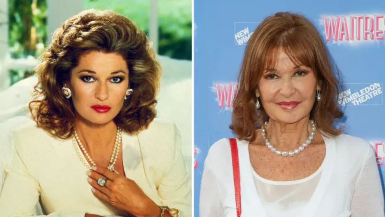 Stephanie Beacham before and after plastic surgery. houseandwhips.com