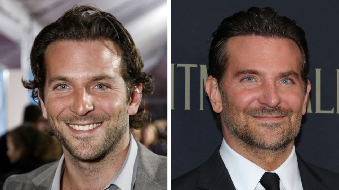 Bradley Cooper before and after plastic surgery. houseandwhips.com