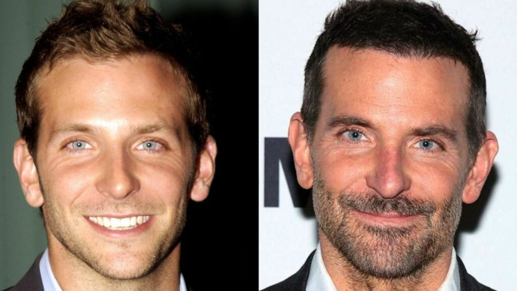 Bradley Cooper Looks Youthful After Alleged Plastic Surgery! houseandwhips.com