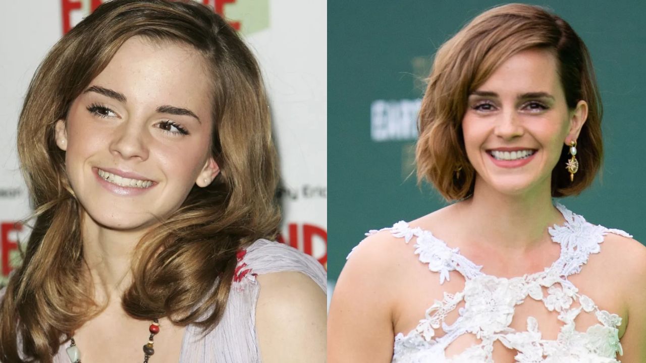 Emma Watson didn't seem to be fond of the idea of plastic surgery. houseandwhips.com