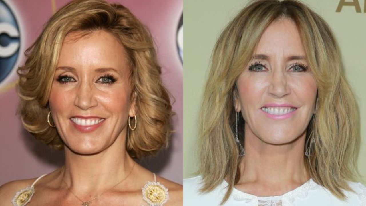 Felicity Huffman before and after plastic surgery. houseandwhips.com