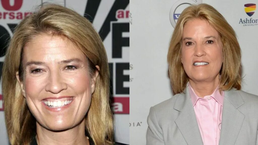 Greta Van Susteren is very candid about her plastic surgery. houseandwhips.com