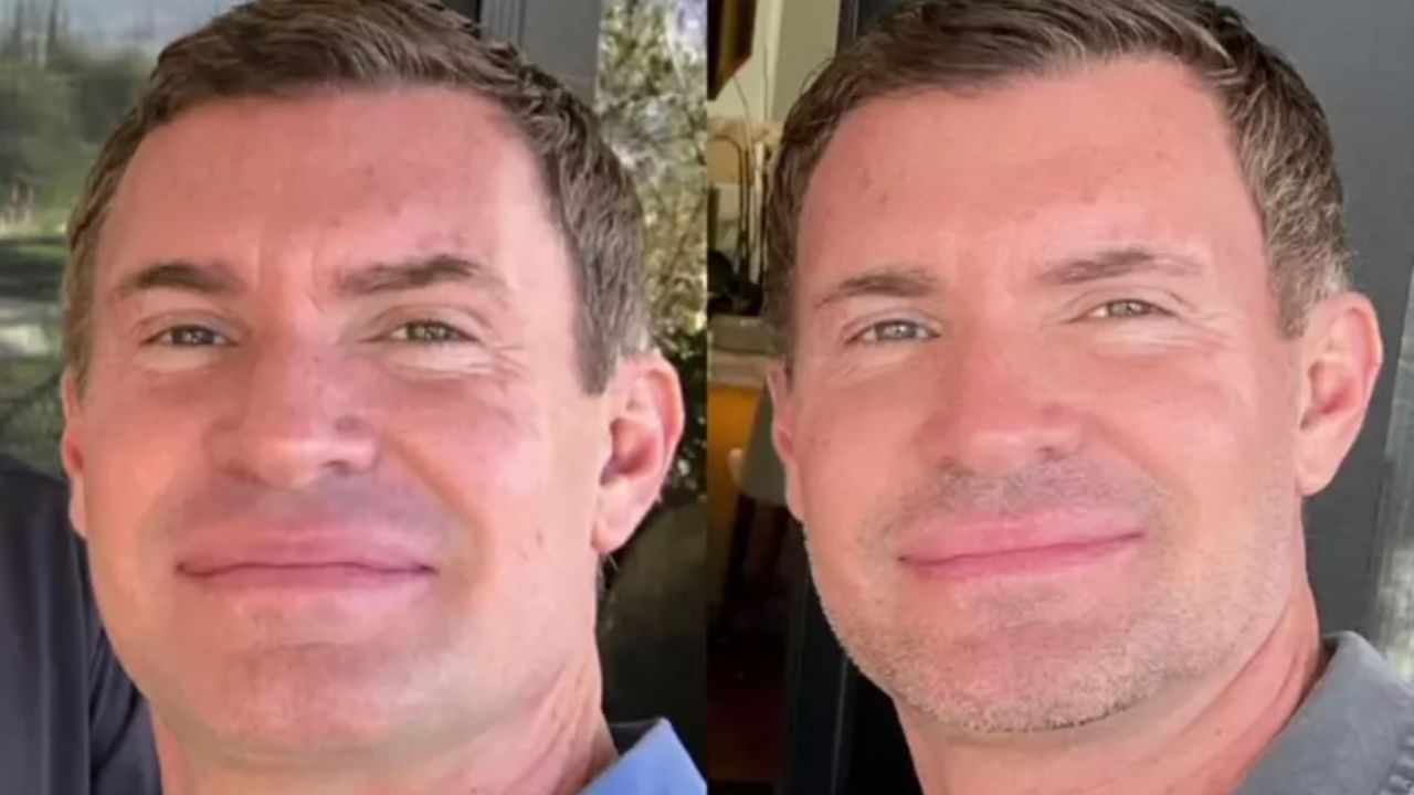 Jeff Lewis before and after plastic surgery. houseandwhips.com