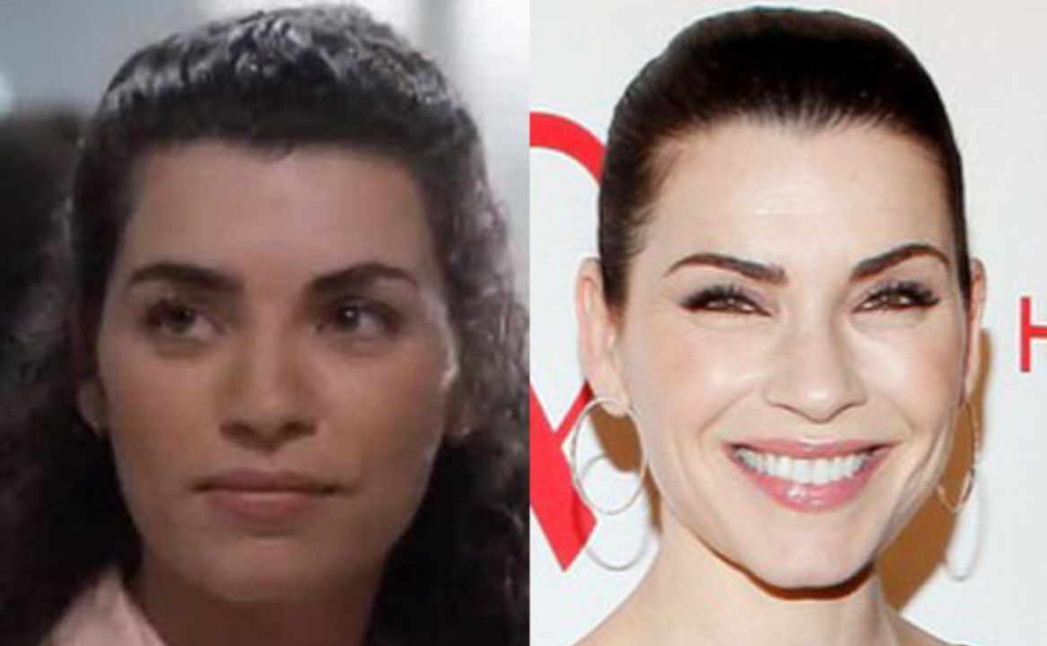 Julianna Margulies before and after plastic surgery. houseandwhips.com