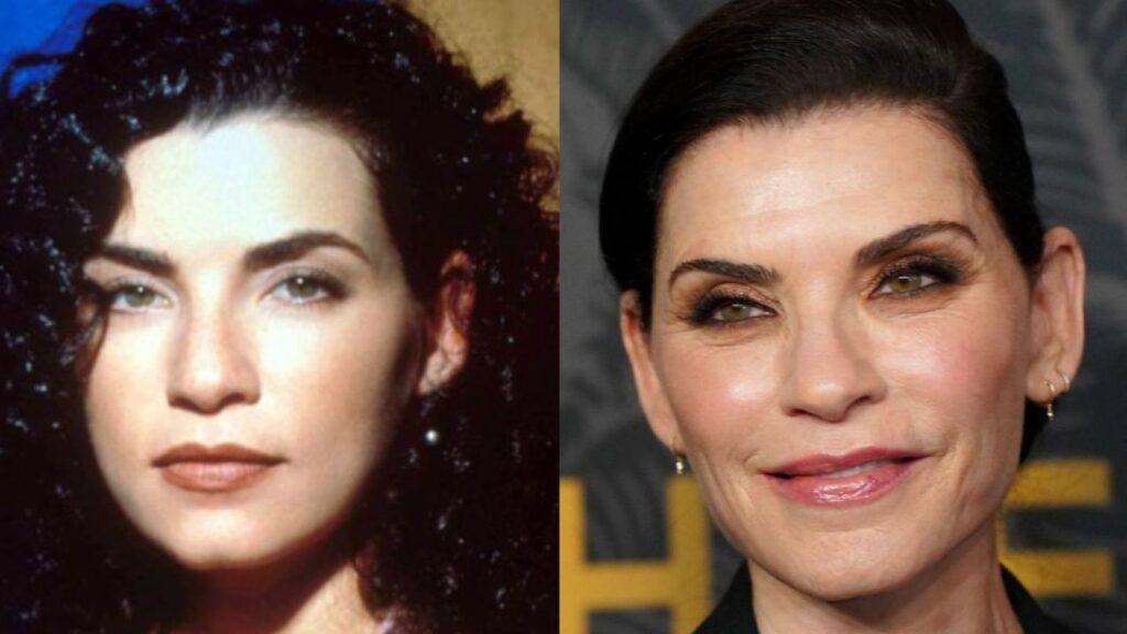 Julianna Margulies Doesn’t Look Natural After Plastic Surgery! houseandwhips.com
