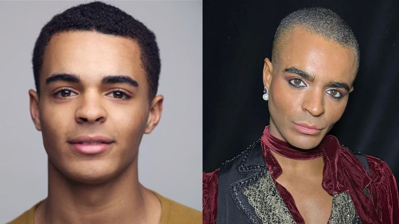 Layton Williams seems to have had plastic surgery to reshape his face. houseandwhips.com