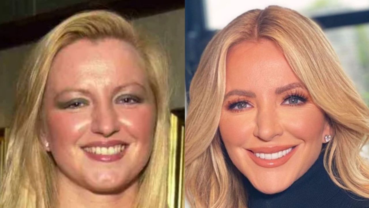 Michelle Mone Before and After Plastic Surgery! houseandwhips.com