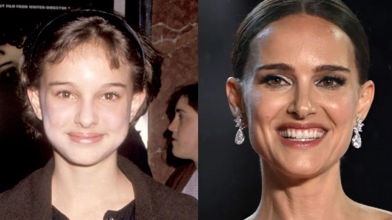 Natalie Portman is suspected of having plastic surgery such as a nose job and eyelid surgery. houseandwhips.com
