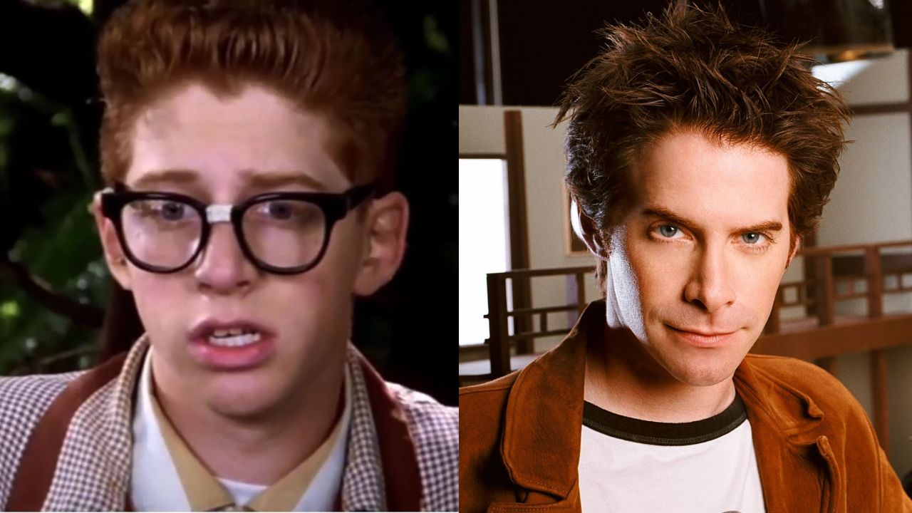 Seth Green seems to have had plastic surgery to alter his nose. houseandwhips.com