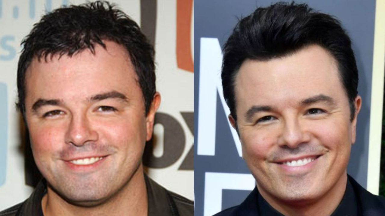 Seth MacFarlane before and after plastic surgery. houseandwhips.com