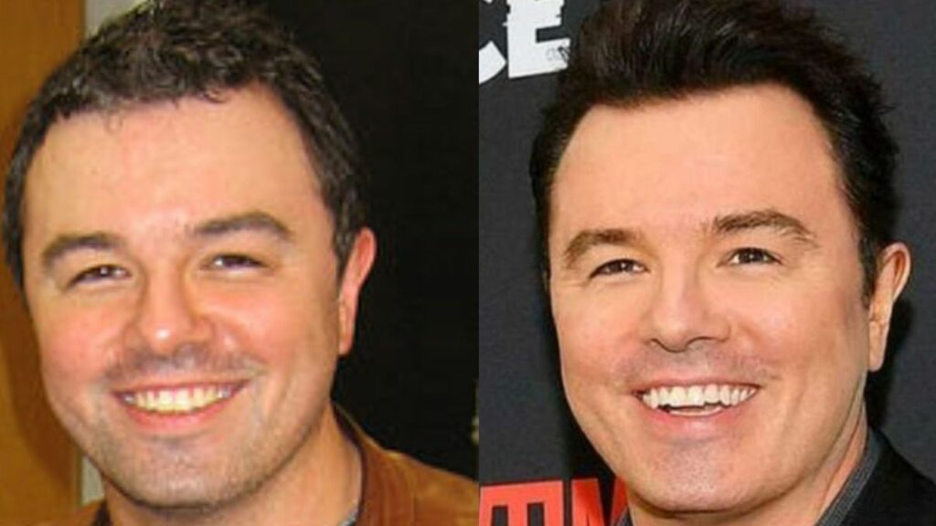 Seth MacFarlane Might Have Received Plastic Surgery to Look Younger! houseandwhips.com