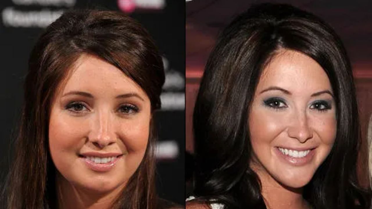 Bristol Palin before and after plastic surgery. houseandwhips.com