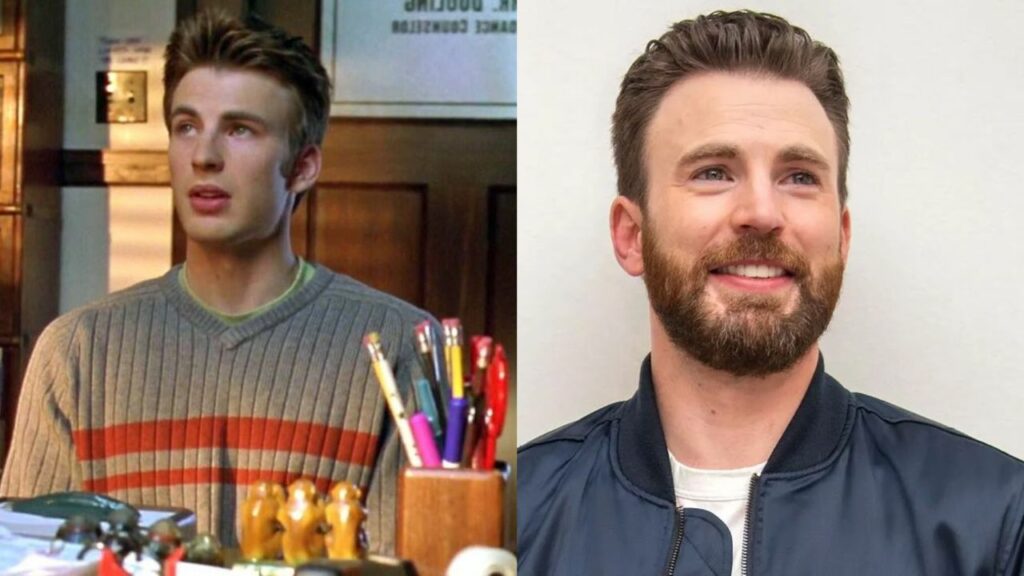 Chris Evans does not appear to have had plastic surgery but he has definitely had it. houseandwhips.com