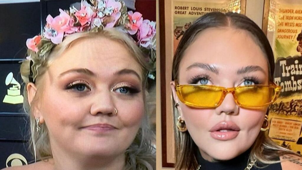 Elle King Taking Help From Plastic Surgery or What? houseandwhips.com